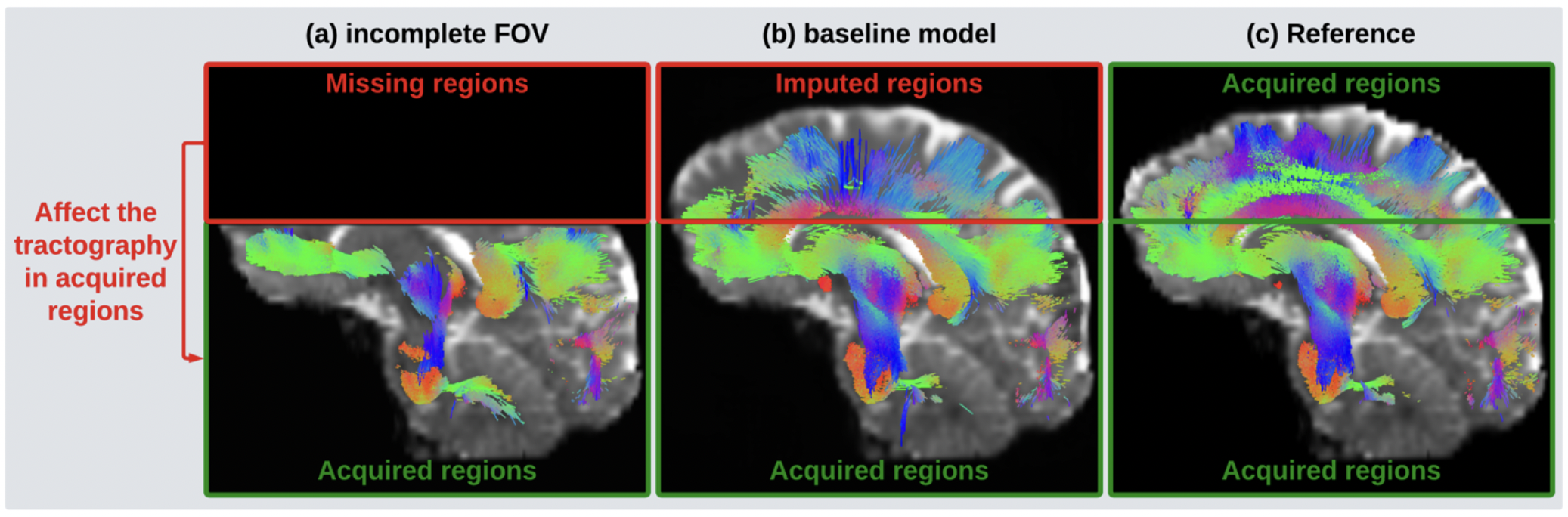 dMRI FOV extension idea